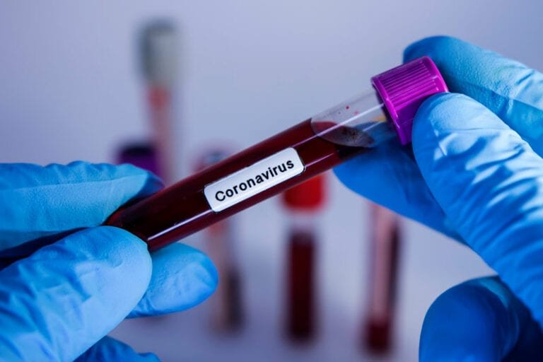 Contaminação por Covid-19 já afastou cerca de 225 policiais civis em São Paulo
